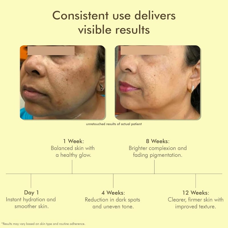 VEDICDERM Kumkumadi DePigmentation Night Cream 50g  Goodness of Saffron  Ceramides  Reduces Pigmentation Dark Spots  Melasma  Evens Skin Tone  Enhances Radiance  Sulfate  Paraben Free - Image 2