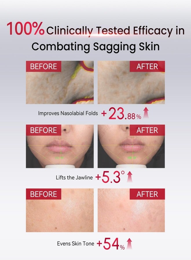 أميرو سيروم الوجه AMIRO PDRN، أمبولات مرطبة بحمض نووي السلمون بتقنية النانو ليبوسوم، خلاصة خفيفة للبشرة لبشرة مشرقة ومشدودة، قوارير للاستخدام الفردي، 0.04 أونصة سائلة × 30 - Image 4