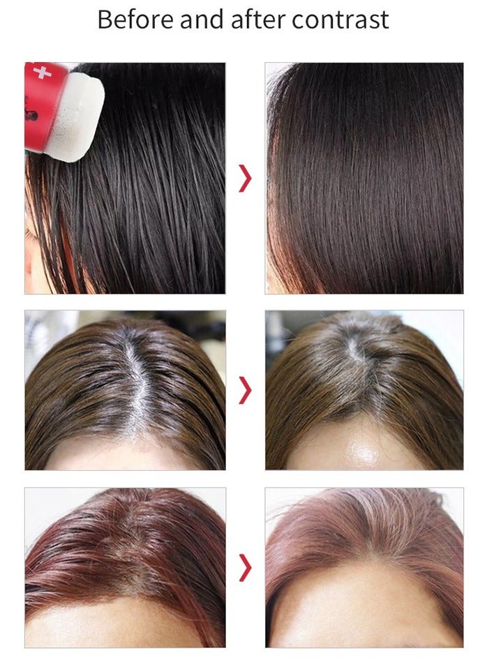 بست مسحوق التحكم في زيت الشعر / رذاذ بدون غسل مسحوق تصفيف الشعر للرجال والنساء مسحوق امتصاص الزيت 10 جرام - Image 4