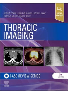 Thoracic Imaging: Case Review 
