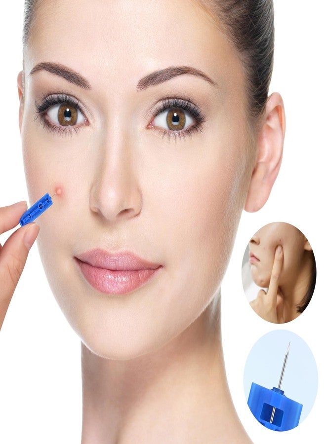 Lishae Acne Needle, 50 Pcs Disposable sterile Needles and 70 Dots Pimple Stickers for Acnes, Whitehead, Comedone Removal (122 Piece Set) - Image 5