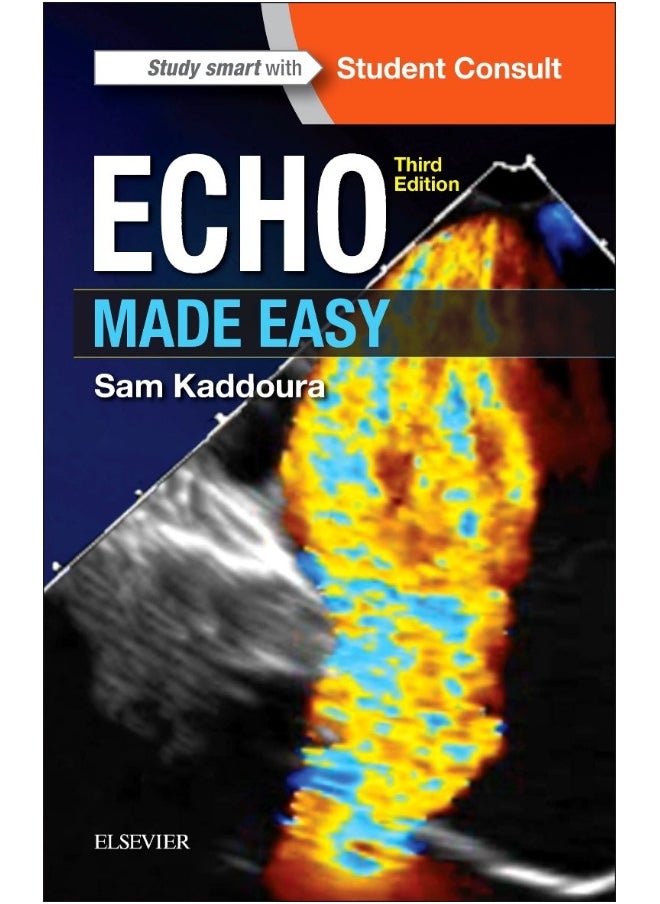 Echo Made Easy