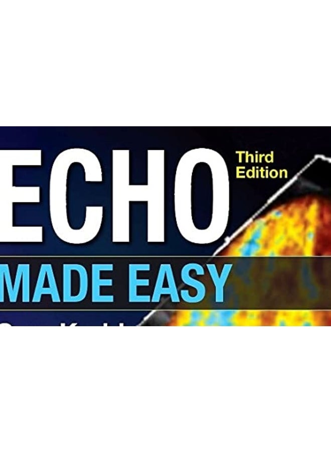 Echo Made Easy