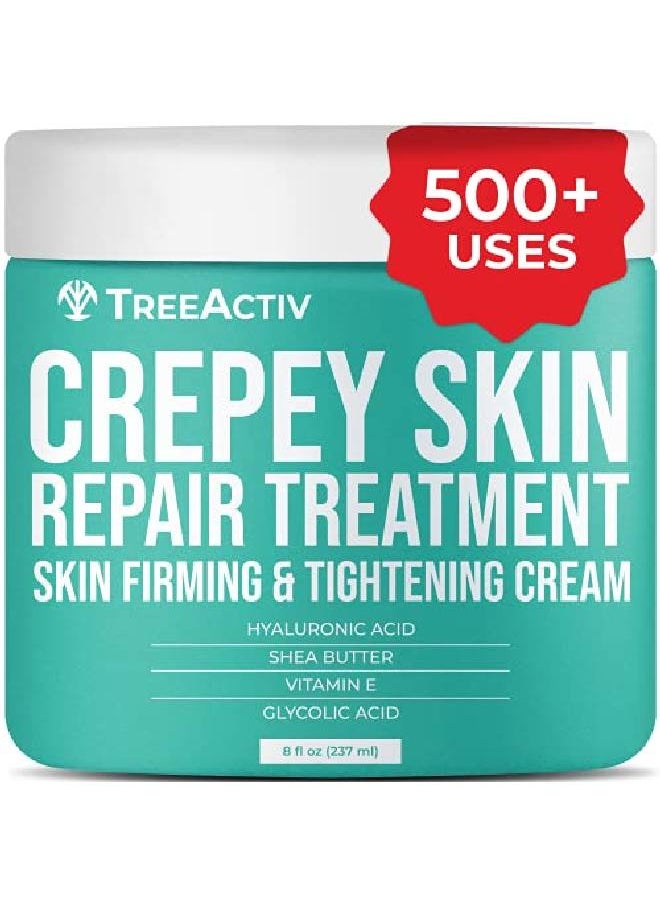 TreeActiv Crepey Skin Repair Treatment ; Hyaluronic Acid Skin Firming & Tightening Lotion For Sagging Neck Arms Chest & Legs ; Antiaging & Antiwrinkle Cream & Stretch Marks Remover ; 500+ Uses  - Image 2