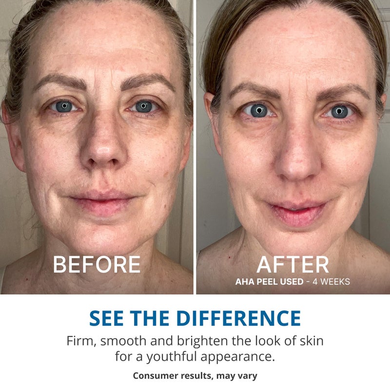 goPure Wake Up Radiant AHA Peel â€“ Gentle Resurfacer, Visibly Brightens Dark Spots, Smooths the Look of Rough Skin & Visibly Firms Lines, Great For All Skin Types - Image 5