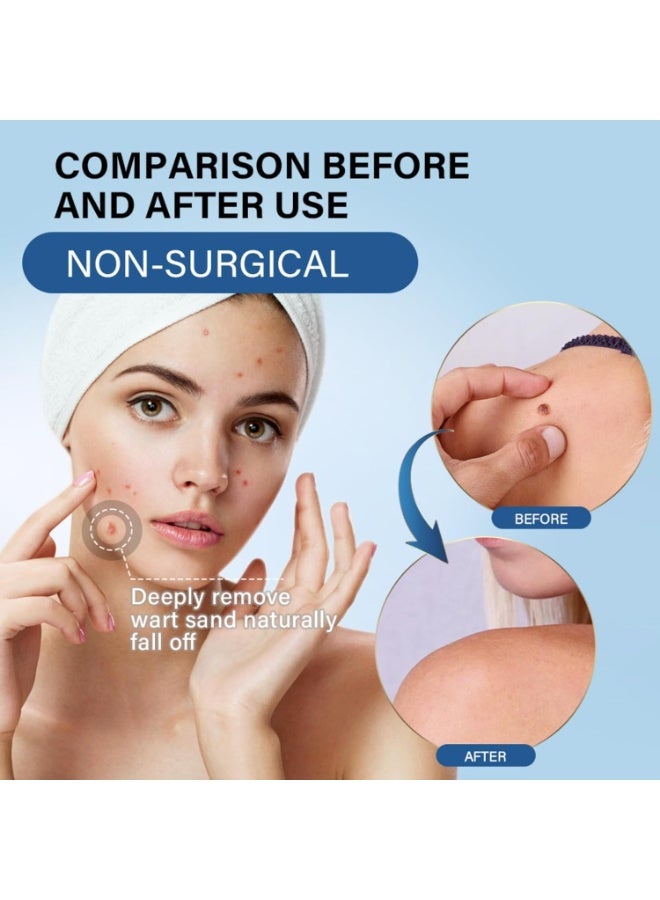 Wart Remover Cream, Skin Tag Remover Warts Removal Cream, Wart Removal Ointment with Pure Essential Oils Natural Extract Wart Remover Ointment for Face, Neck, Body, Hands, Feet for Bedroom - Image 2