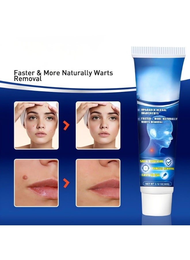 Wart Remover Cream, Skin Tag Remover Warts Removal Cream, Wart Removal Ointment with Pure Essential Oils Natural Extract Wart Remover Ointment for Face, Neck, Body, Hands, Feet for Bedroom - Image 5