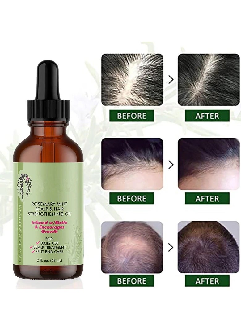 DubaiGallery - Rosemary Hair Growth Essential Oil Anti Hair Loss Fast Regrowth Essence Aromatherapy Repair Damaged Frizzy Thinning Scalp Hair-restorer Dense Hair Growth Serum（30ml - Image 1