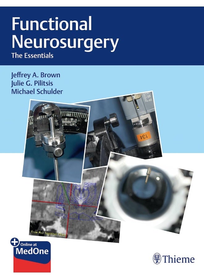 Functional Neurosurgery: The Essentials 