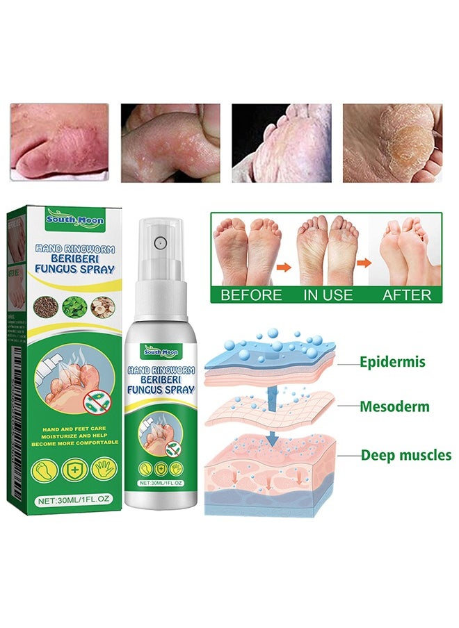 SOUTH MOON Hand Ringworm BeriBeri Fungus Spray, Anti-Fungi Treatment For Feet Itchy, Sweating, Peeling And Blisters, Natural Ingredients Foot Fungi Spray For Tinea Pedis, Inflamed, Feet Smelly 30ML  - Image 2