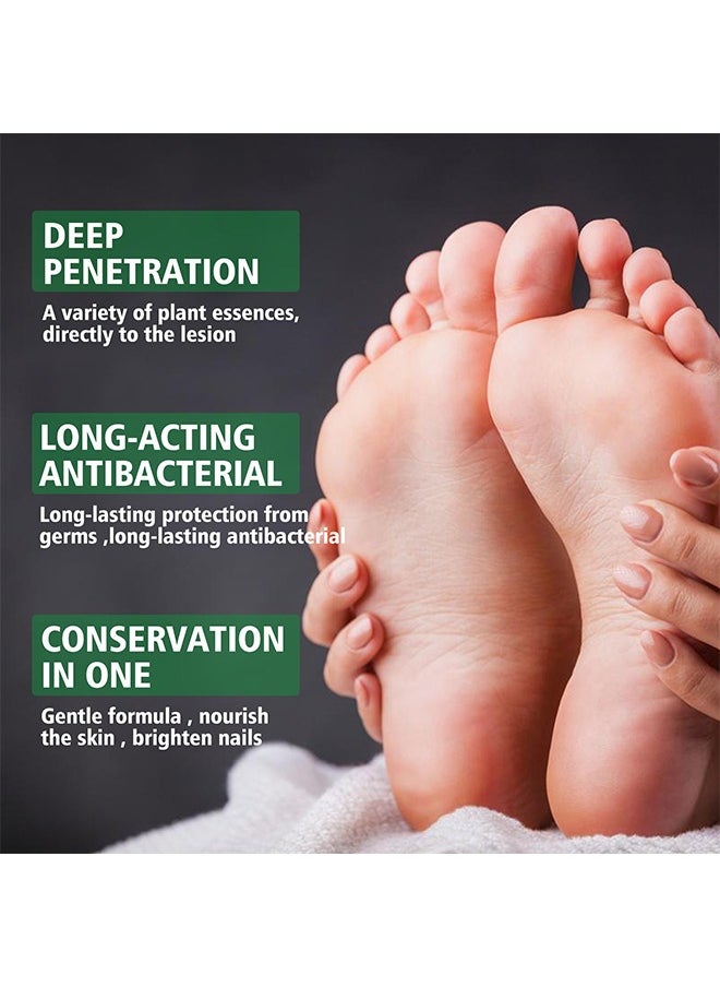 SOUTH MOON Hand Ringworm BeriBeri Fungus Spray, Anti-Fungi Treatment For Feet Itchy, Sweating, Peeling And Blisters, Natural Ingredients Foot Fungi Spray For Tinea Pedis, Inflamed, Feet Smelly 30ML  - Image 3