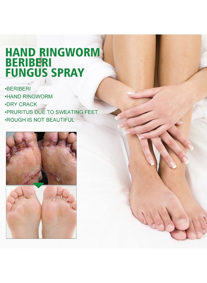 SOUTH MOON Hand Ringworm BeriBeri Fungus Spray, Anti-Fungi Treatment For Feet Itchy, Sweating, Peeling And Blisters, Natural Ingredients Foot Fungi Spray For Tinea Pedis, Inflamed, Feet Smelly 30ML  - Image 4