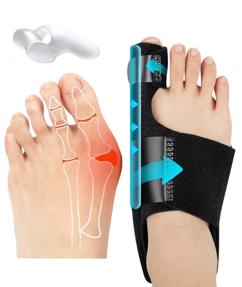 QualiTrue Bunion Corrector for Women and Men Toe Separator One Feet Bunion Splint, Big Toes Separation Pain Relief, Non-Surgical Adjustable Hallux Valgus Bunions Thumb Straightener, Hammer Toe Day Night Support (1 Bunion Corrector + 1 Toe Separator) - Image 1
