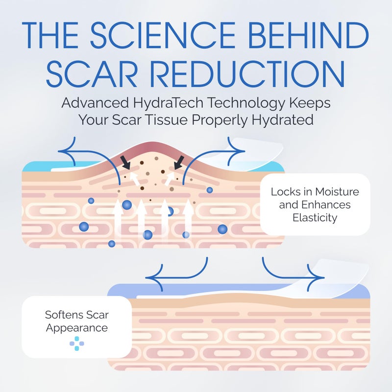 ScarScience Advanced Medical Grade Silicone Scar Patches, 12 Reusable 3" Water-Resistant Silicone Scar Strips for Newly Healed Wounds and Older Scars - Breathable Silicone Gel Sheets for Scars w/Case - Image 4