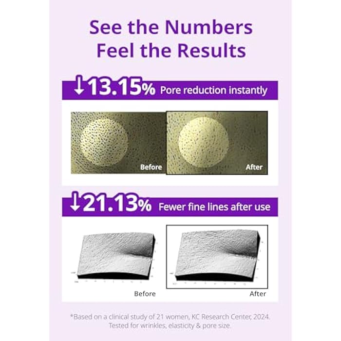 SNP 10,000ppm Deep Collagen + PDRN + Retinol Hydrogel Mask | 8 Layer 125Da Collagen Face Mask | Overnight Facial Mask | Patent Skin Hydration | Hydrating Facial Mask | Face Mask Skin Care | 4 Sheets - Image 4