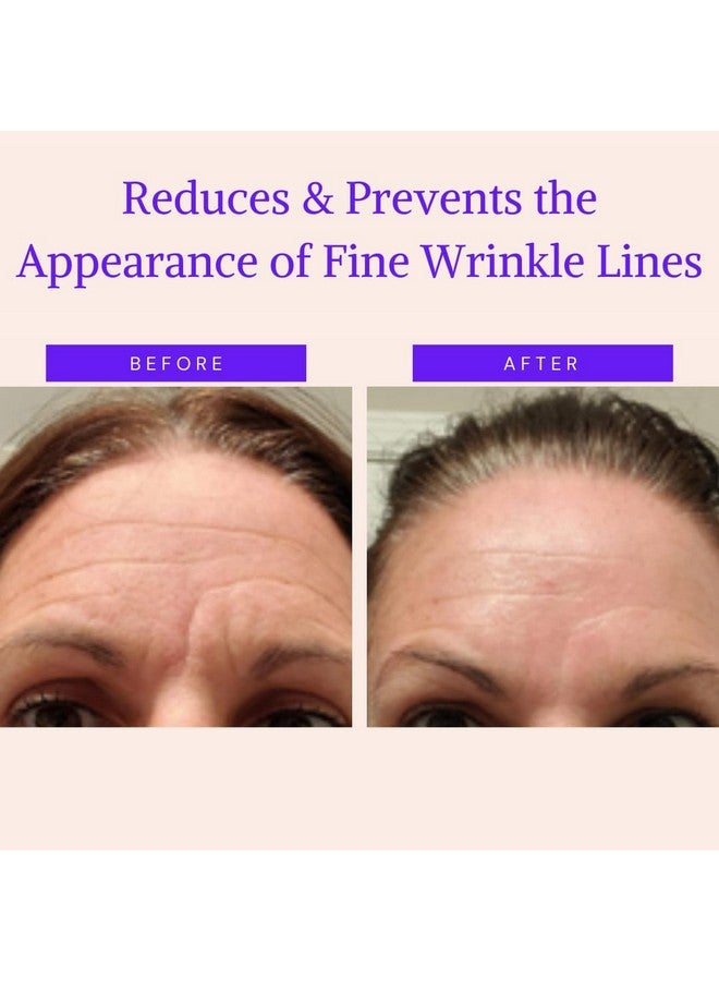 BLUMBODY Antiaging Face Wrinkle Treatment Nourishes Smooths And Natural Nonsilicone Wrinkle Patches For Fine Lines Wrinkles Eye Mouth Forehead 30 Day Supply - Image 2