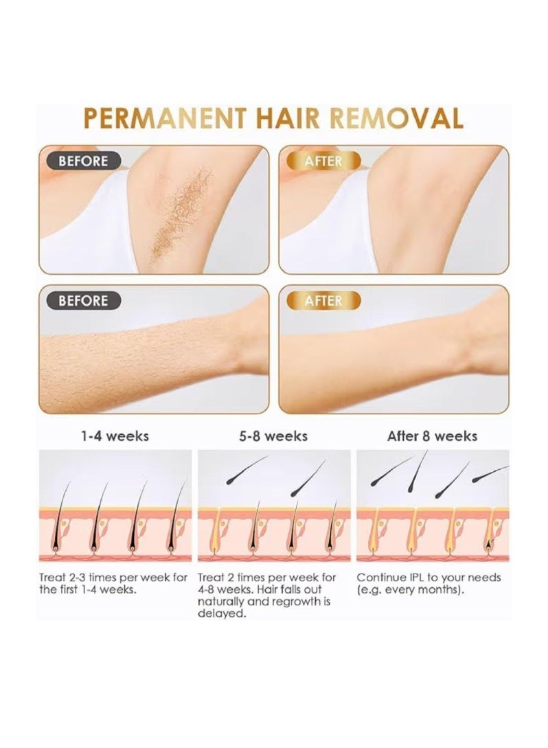 Home Laser Hair Removal Device, High Power, Root Inhibition Technology - Image 4