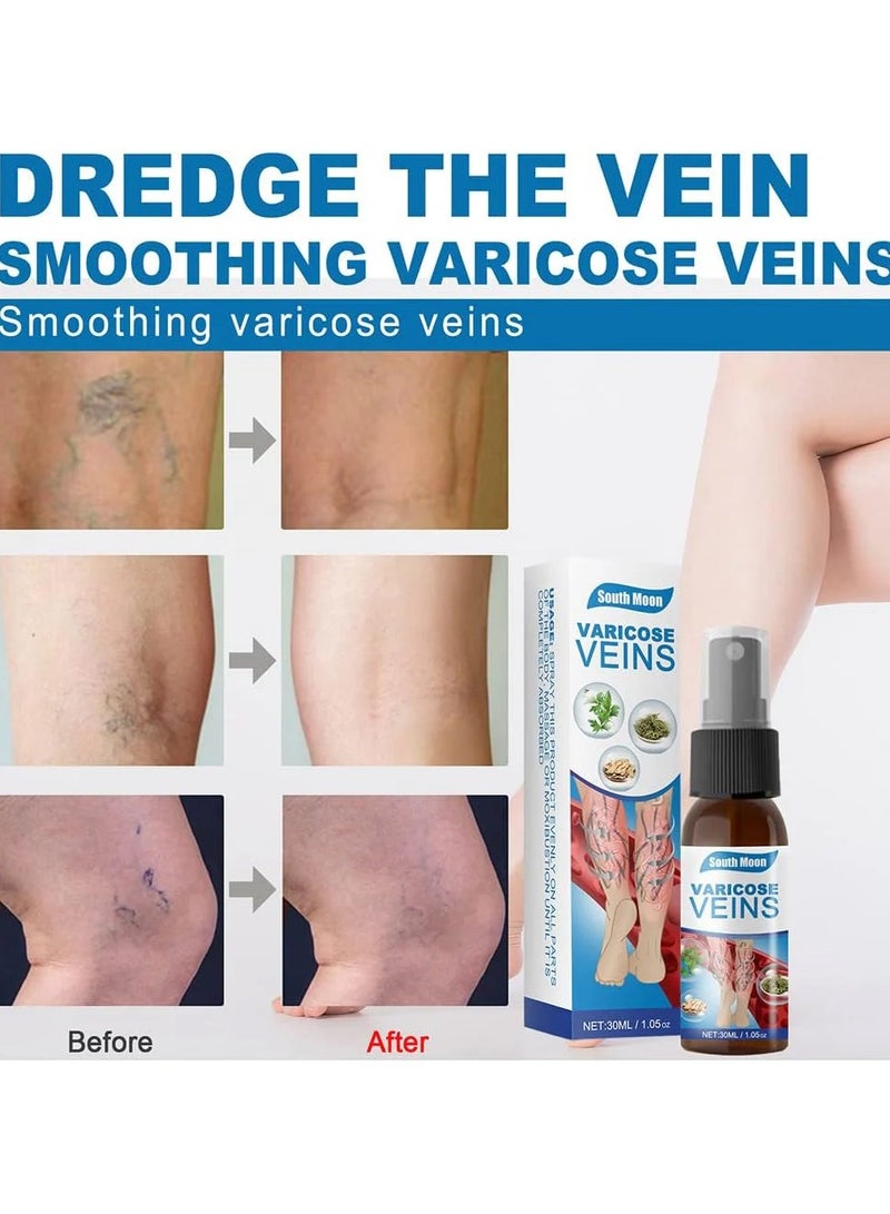 SOUTH MOON Veinhealing Varicose Veins Treatment Spray, Varicose Veins Spray, Varicose Vein Soothing Spray Vein Treatment Spray, Veinhealing Varicose Veins Spray for Legs - Image 3
