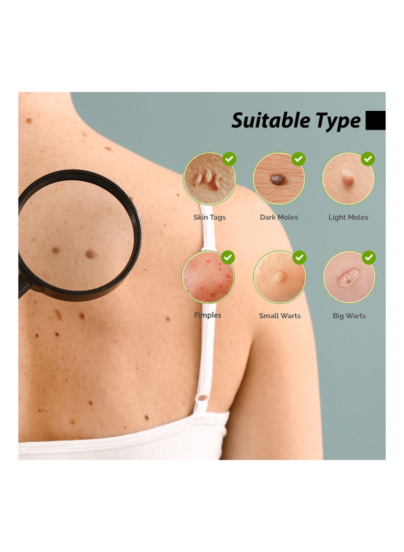 EELHOE Alive Skin Mole Removal 10ml  - Image 3
