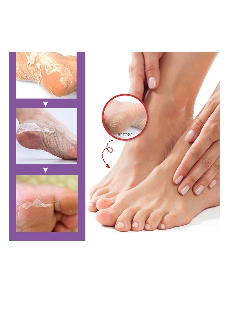 بوتيمي زوجان من قناع القدمين بالألوفيرا للأقدام الجافة والمتشققة، يزيل الجلد الميت، قناع القدمين المرطب بالنياسيناميد، مرطب، مُصلح، مُغذي، مُقشر، عناية ناعمة بالبشرة، الأقدام الجافة والمتشققة، يزيل الجلد الميت - Image 2