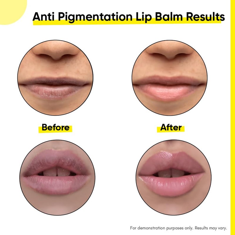 Masofta Anti Pigmentation Lip Balm With Kojic AcidAlpha Arbutin Shea Butter For SmoothCrack Free Clear LipsSpf 30 PaFor Men Women15GmsAll - Image 3