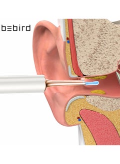Bebird T15 Ear Wax Removal Tool, Ear Cleaner With Camera, Squeeze Acne Tool（Inside The Top Cover Cap), Wireless Otoscope Compatible With Iphone, Ipad, Android Phones  - Image 3
