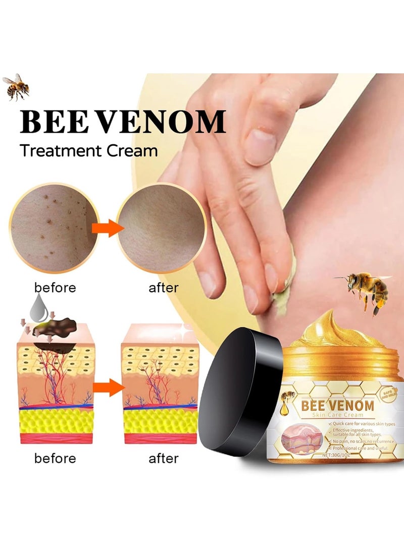 Houkea Bee Venom Moles and Wart Removal Cream Mole and Wart Cream Easy Application and No Irritation Wart and Tag Remover Bee Venom Repair Cream Wart Treatment Cream  - Image 2