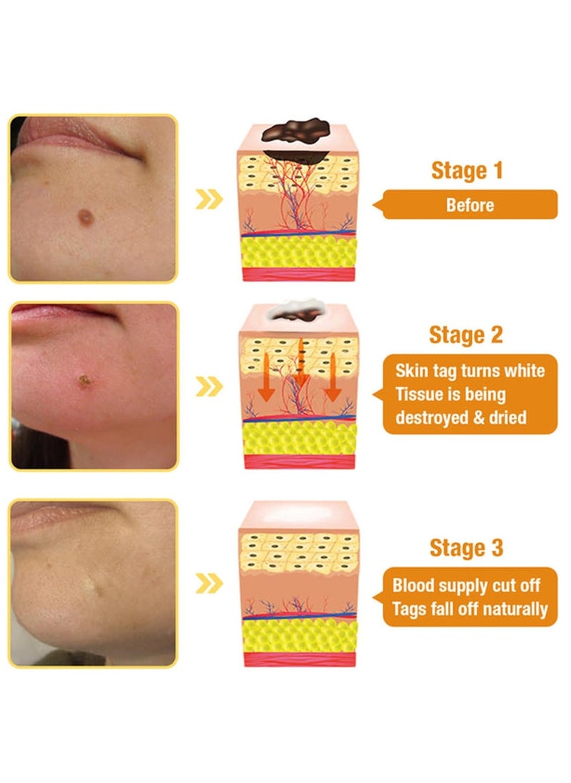 Houkea Bee Venom Moles and Wart Removal Cream Mole and Wart Cream Easy Application and No Irritation Wart and Tag Remover Bee Venom Repair Cream Wart Treatment Cream  - Image 3