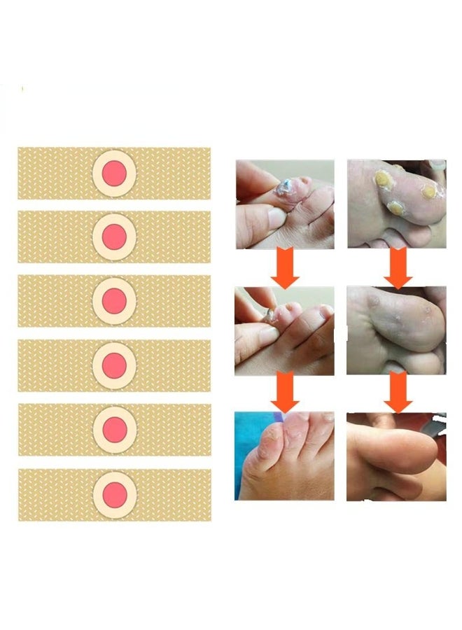 Generic New 12 Pcs Foot Corn Removal Killer Calluses Plantar  - Image 2