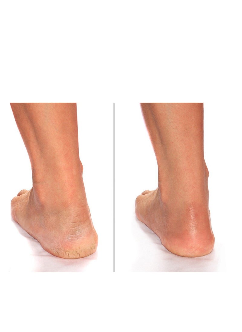 Advanced Clinicals Advanced Clinicals Cracked Heel Foot Cream Skin Care Moisturizer Lotion For Feet W/Shea Butter | Helps Heal Cracked Skin, Rough Spots, Calluses, & Dry Skin | Foot Lotion | Hand Lotion| Large 8 Fl Oz  - Image 4