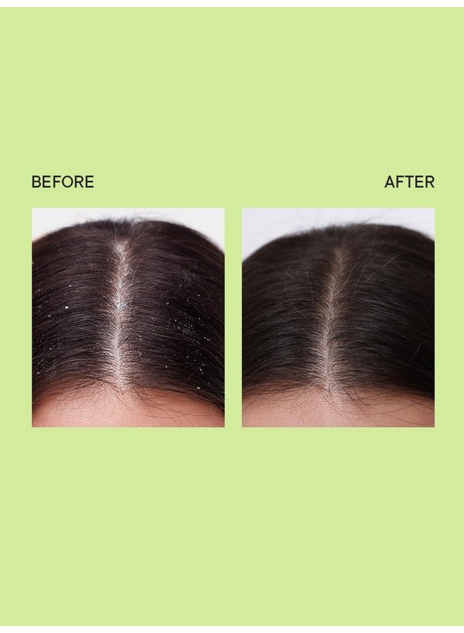 Quench Dandruff Control Hair Serum With Tea Tree Extracts | Treats Dandruff, Flakes & Greasy Scalp | Strengthens & Deeply Conditions | Made In Korea (100Ml) - Image 5