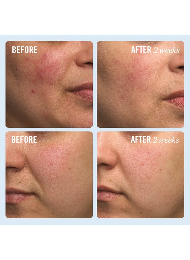 فيرست إيد بيوتي كريم الإصلاح الفائق، مرطب الترطيب المكثف للوجه والجسم، 1 أونصة - Image 3