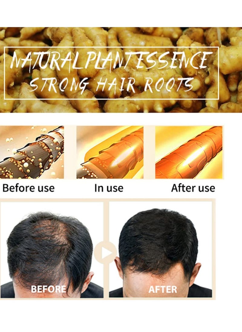 MAITING 3 Pcs Natural Ginger Shampoo Bar for Hair Regrowth - Promotes Hair Growth, Anti Hair Loss  - Image 5