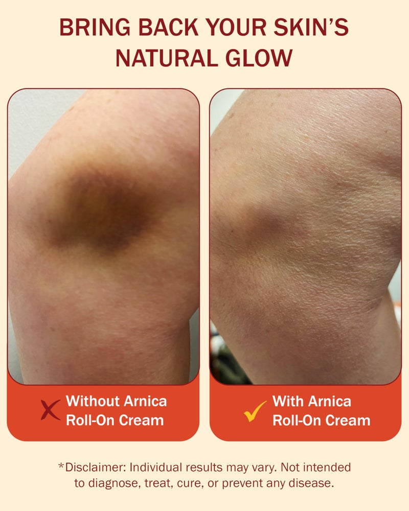 e70 كريم أرنيكا e70، طبيعي، مهدئ، غير دهني وبدون رائحة، 4 أونصة (عبوة من 1) - Image 4