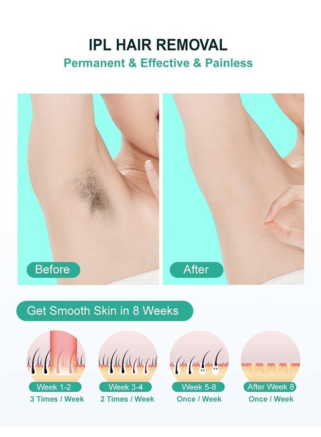 general IPL Hair Removal,Laser Hair Removal At-Home for Women Men, 999,999 Flashes Permanent Hair Removal Device on Facial Legs Arms Bikini Line - Image 3