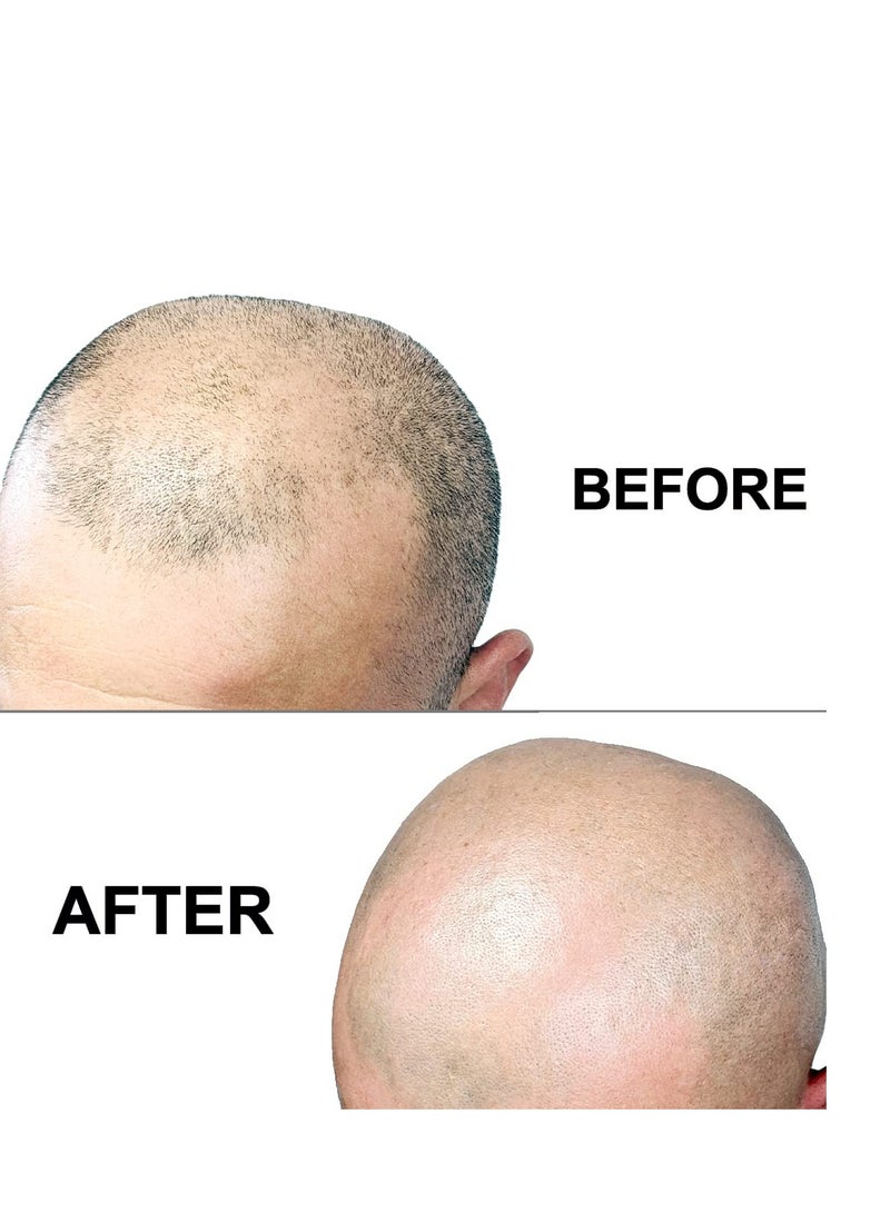 Premium Omnishaver Bi-Directional Shavers for Men & Women | 10x Faster Than Disposable Razors | Self-Cleaning, Self-Stropping Razor Blades for Shaving Head, Legs, Arms, Body | No Rinsing During Shave