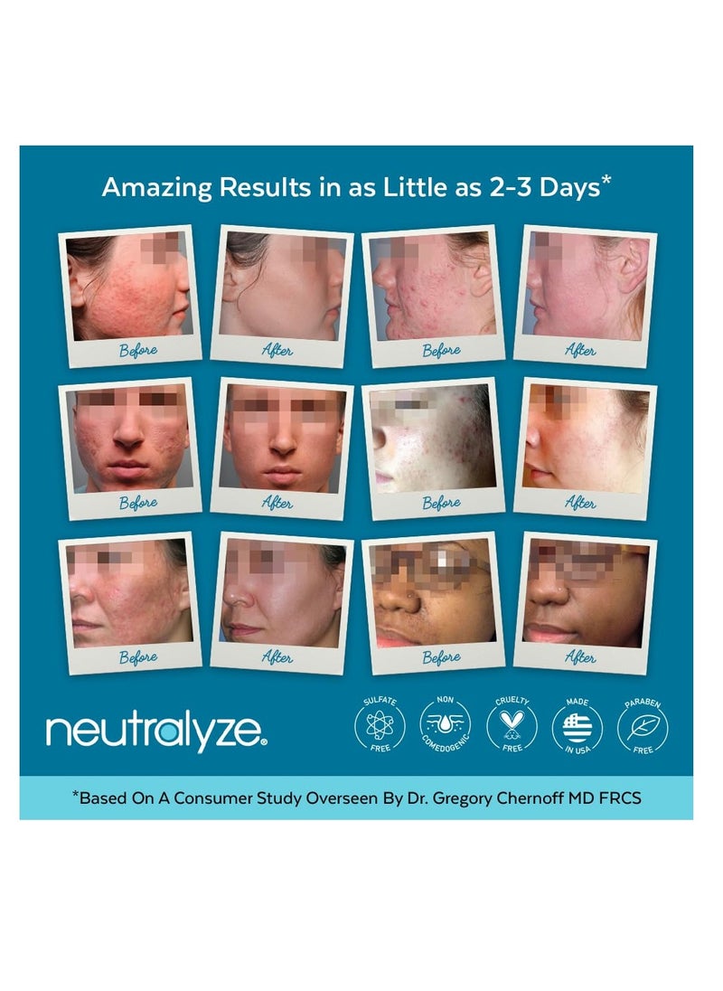 Neutralyze Maximum Strength Acne Face Wash With 2% Salicylic Acid & 2% Mandelic Acid, Medical Grade AHA + BHA Facial Cleanser for Acne Prone Skin (90+ Day)  - Image 4