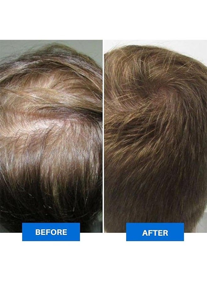 Handheld Head Massager, Electric Scalp Massager for Self Care or Headaches, Handheld Head Scratcher for Stress Relief, Deep Cleaning, Full Body Massage, White - Image 5