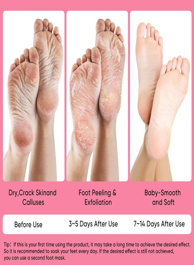 Berlaney Peach Foot Peeling Mask 3 Pairs, Exfoliator for Cracked Heels & Callus - Image 5