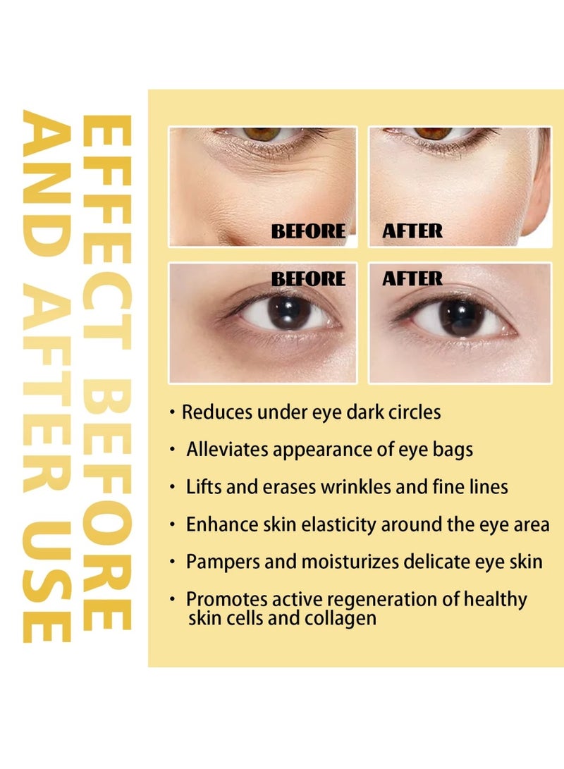 Hoygi Under Eye Rollerball Frankincense Essential Oil Eye Roller with Castor Oil for Dark Circles Puffy Eyes and Wrinkles, Anti Aging Eye Serum Eye Massage Care Relieve Eye Fatigue Massage Roller Ball Eye Cream - Image 5