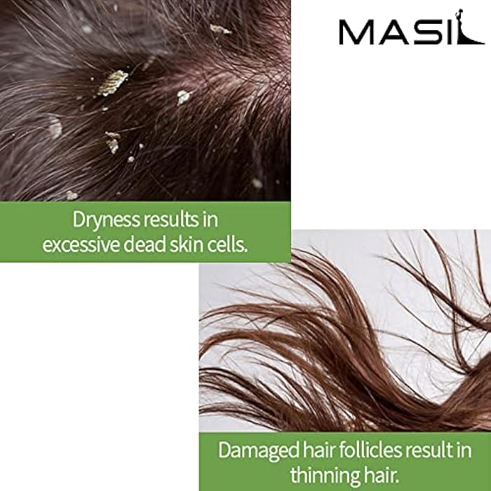 MASIL شامبو ماسيل بروبيوتيك خل التفاح - 5.1 أونصة سائلة، يقلل من حكة فروة الرأس، قشرة الرأس والتجاعيد، خالي من الكبريتات، يستعيد اللمعان مع فيتامين E ودرجة حموضة مثالية - Image 3