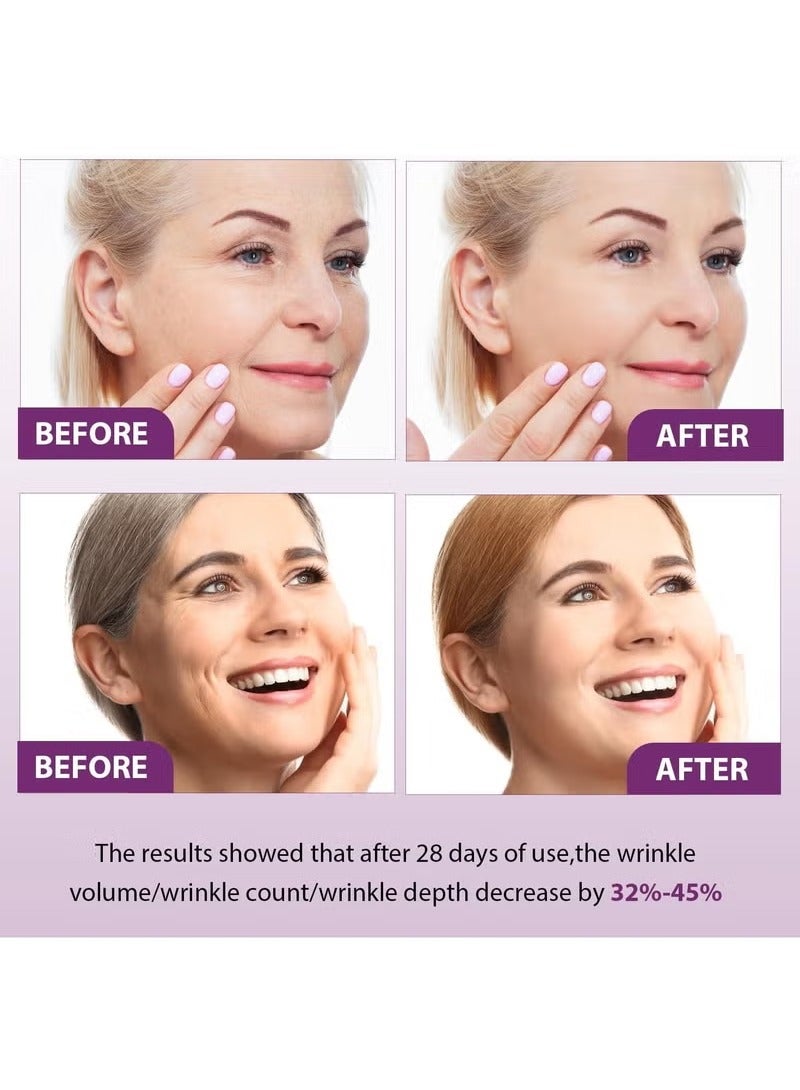 فانستا Bakuchiol الريتينول الجوهر ، المضادة للتجاعيد اشراق الجلد تجديد الريتينول الجوهر ، جوهر الوجه للرجال والنساء الريتينول - Image 5