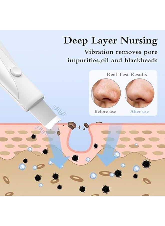 ملعقة سباتولا لتنظيف البشرة وإزالة الرؤوس السوداء وتنظيف المسام بعمق، أداة عناية بالبشرة للرجال والنساء، لون أبيض - Image 3