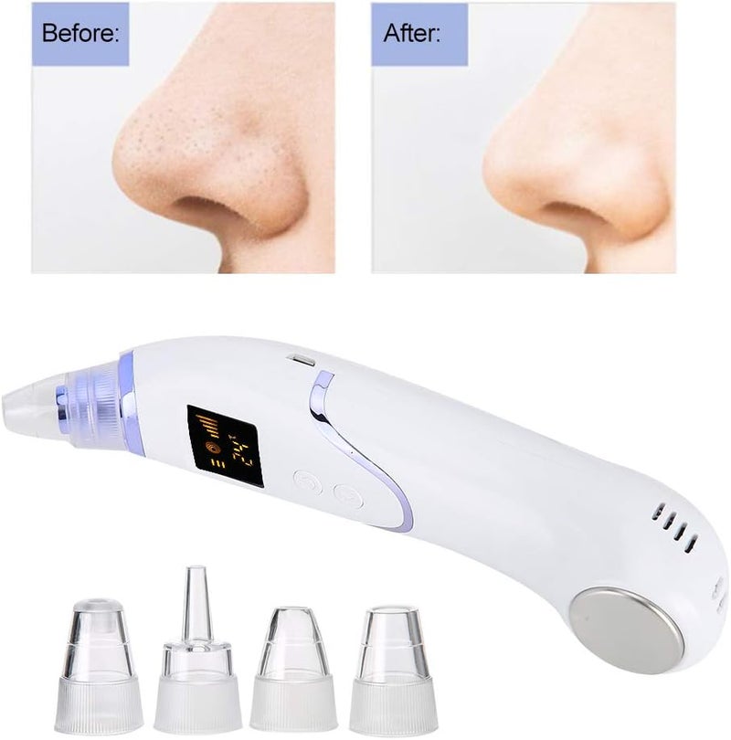 ويوبلز جهاز شفط الرؤوس السوداء، يزيل الرؤوس السوداء والبيضاء والشوائب والزيوت. مزيل الرؤوس السوداء من بيوتي ميسك، تنظيف عميق، إنعاش وتجديد البشرة، شد البشرة. - Image 4