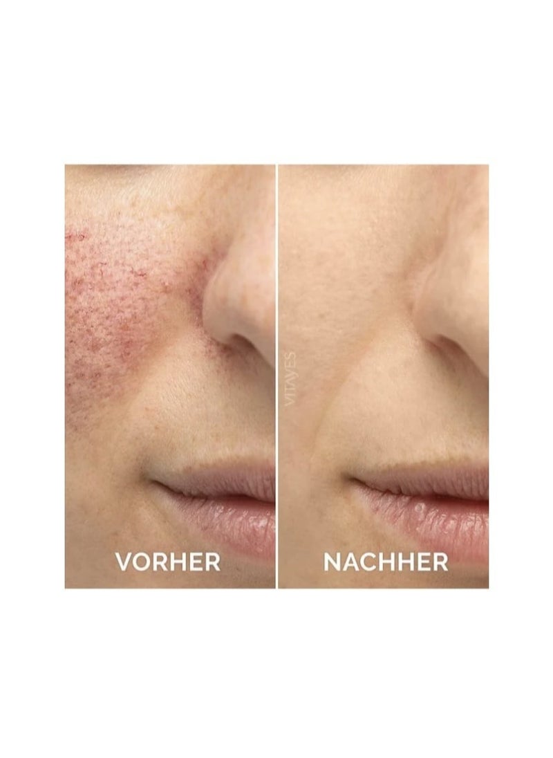 Vitayes - Vitamin C Face Serum Anti Aging Serum With Hyaluronic Acid Skin Hydrating & Brightening For Dark Spots Fine Lines And Wrinkles 1 Oz. - Image 1
