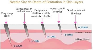 Derma Roller 10mm Micro Needling Roller for Men and Women Facial Roller for Beard Growth Scar Removal and Facial Skin Care Hair Growth Stimulator Pink - Image 4