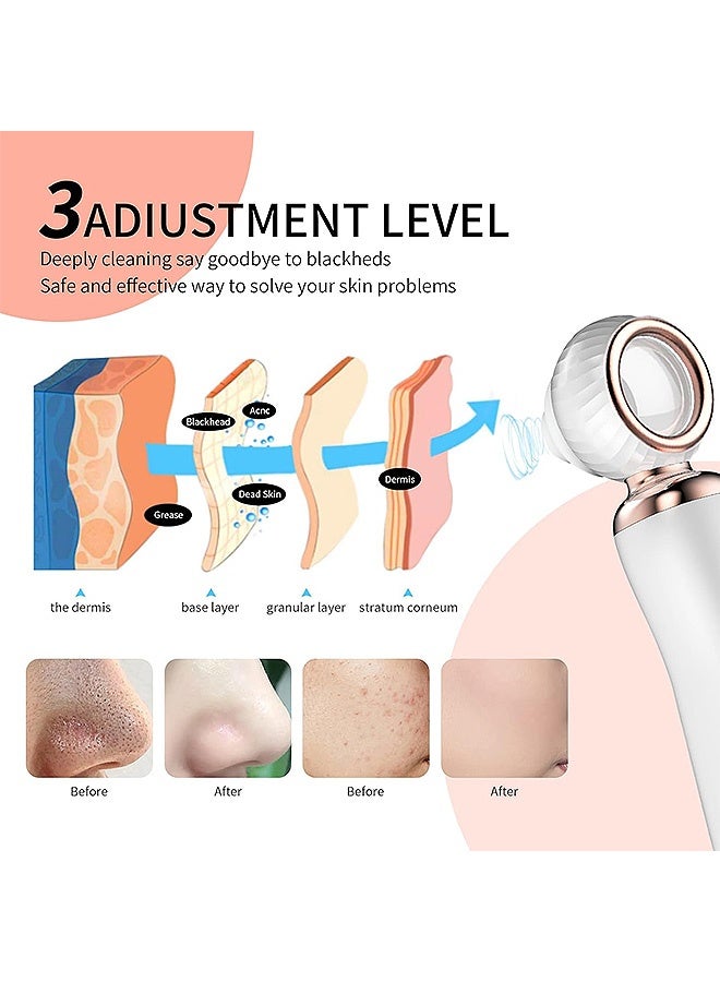 Photon Facial Pore Cleaner, Blackhead Remover Electronic Facial Pore Cleaner Acne Vacuum, Visual Rechargeable Blackhead Vacuum Facial Pore Cleaner-3 Suction Soft Silicone with 3 Probes - Image 5