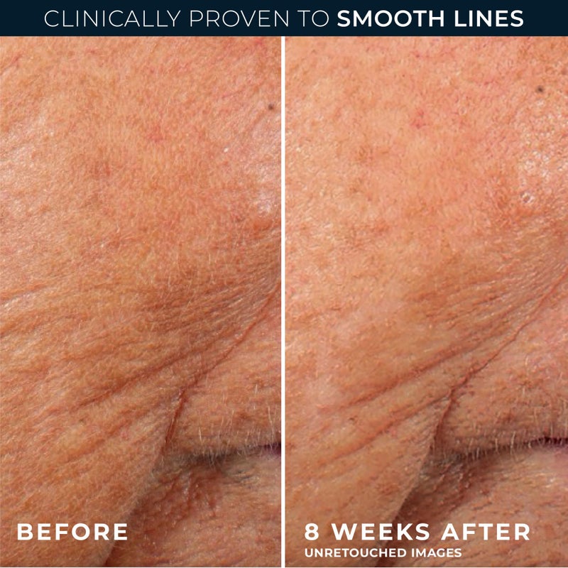 RoC سيروم ليلي مضاد للشيخوخة والتجاعيد من RoC Retinol Correxion، علاج يومي لتنعيم الخطوط الدقيقة والبقع الداكنة وندبات ما بعد حب الشباب، بدون رائحة، حشو جوارب، 30 كبسولة فردية، 0.35 أونصة - Image 5