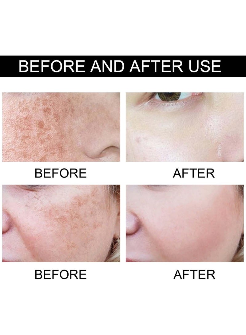 EELHOE Eelhoe Retinol + Vitamin C Dark spot Corrector, Fade Dark Spots and Chloasma, Moisturizing and Nourishing Cream, Softens The Skin. - Image 4