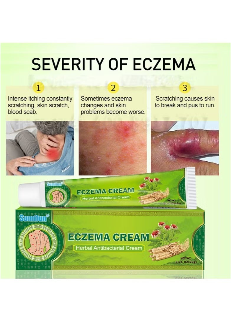 سوميفون كريم علاج الصدفية والأكزيما مضاد للبكتيريا ومضاد للحكة والتهاب الجلد مرهم عشبي مضاد للحكة لصقة طبية - Image 2